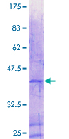 ab158244 on a 12.5% SDS-PAGE stained with Coomassie Blue.