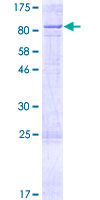 ab158257 on a 12.5% SDS-PAGE stained with Coomassie Blue.