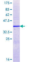 ab166287 on a 12.5% SDS-PAGE stained with Coomassie Blue.