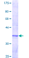 ab158259 on a 12.5% SDS-PAGE stained with Coomassie Blue.