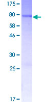 ab158247 on a 12.5% SDS-PAGE stained with Coomassie Blue.