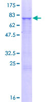 ab158246 on a 12.5% SDS-PAGE stained with Coomassie Blue.