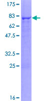 ab158251 on a 12.5% SDS-PAGE stained with Coomassie Blue.