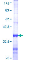 ab158252 on a 12.5% SDS-PAGE stained with Coomassie Blue.