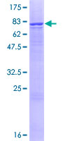 ab165164 on a 12.5% SDS-PAGE stained with Coomassie Blue.