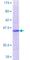 ab165008 on a 12.5% SDS-PAGE stained with Coomassie Blue.