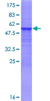 ab163886 on a 12.5% SDS-PAGE stained with Coomassie Blue.