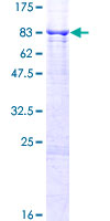 ab166203 on a 12.5% SDS-PAGE stained with Coomassie Blue.