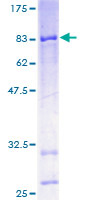ab166094 on a 12.5% SDS-PAGE stained with Coomassie Blue.