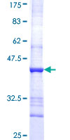 ab158260 on a 12.5% SDS-PAGE stained with Coomassie Blue.