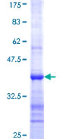 ab160482 on a 12.5% SDS-PAGE stained with Coomassie Blue.