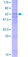 ab153131 on a 12.5% SDS-PAGE stained with Coomassie Blue.