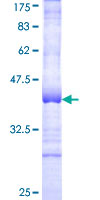 ab153132 on a 12.5% SDS-PAGE stained with Coomassie Blue.