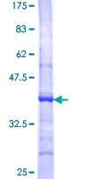 ab160077 on a 12.5% SDS-PAGE stained with Coomassie Blue.