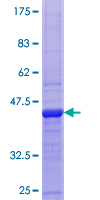 ab158221 on a 12.5% SDS-PAGE stained with Coomassie Blue.
