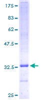 ab162235 on a 12.5% SDS-PAGE stained with Coomassie Blue.