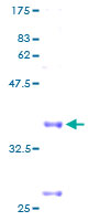ab158177 on a 12.5% SDS-PAGE stained with Coomassie Blue.