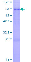 ab158245 on a 12.5% SDS-PAGE stained with Coomassie Blue.