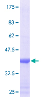ab153423 on a 12.5% SDS-PAGE stained with Coomassie Blue.