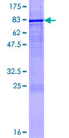 ab158253 on a 12.5% SDS-PAGE stained with Coomassie Blue.