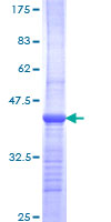 ab158254 on a 12.5% SDS-PAGE stained with Coomassie Blue.