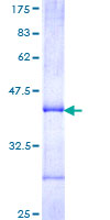 ab158256 on a 12.5% SDS-PAGE stained with Coomassie Blue.
