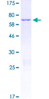 ab158804 on a 12.5% SDS-PAGE stained with Coomassie Blue.