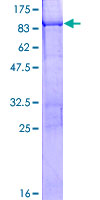 ab162518 on a 12.5% SDS-PAGE stained with Coomassie Blue.