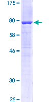 ab158803 on a 12.5% SDS-PAGE stained with Coomassie Blue.