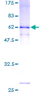 ab160075 on a 12.5% SDS-PAGE stained with Coomassie Blue.