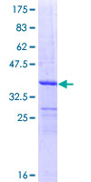 ab160076 on a 12.5% SDS-PAGE stained with Coomassie Blue.