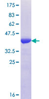 ab165657 on a 12.5% SDS-PAGE stained with Coomassie Blue.