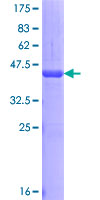 ab153345 on a 12.5% SDS-PAGE stained with Coomassie Blue.