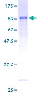ab161866 on a 12.5% SDS-PAGE stained with Coomassie Blue.