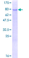 ab162986 on a 12.5% SDS-PAGE stained with Coomassie Blue.