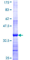 ab165848 on a 12.5% SDS-PAGE stained with Coomassie Blue.