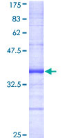 ab153241 on a 12.5% SDS-PAGE stained with Coomassie Blue.
