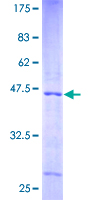 ab163283 on a 12.5% SDS-PAGE stained with Coomassie Blue.