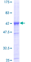ab162069 on a 12.5% SDS-PAGE stained with Coomassie Blue.