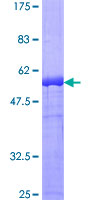 ab162070 on a 12.5% SDS-PAGE stained with Coomassie Blue.