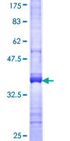 ab162071 on a 12.5% SDS-PAGE stained with Coomassie Blue.