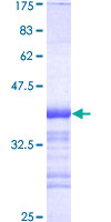 ab161288 on a 12.5% SDS-PAGE stained with Coomassie Blue.