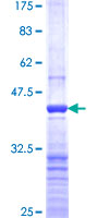 ab158262 on a 12.5% SDS-PAGE stained with Coomassie Blue.