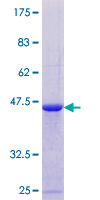 ab160657 on a 12.5% SDS-PAGE stained with Coomassie Blue.