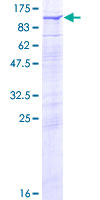 ab161576 on a 12.5% SDS-PAGE stained with Coomassie Blue.