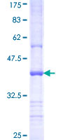 ab161577 on a 12.5% SDS-PAGE stained with Coomassie Blue.