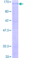 ab161204 on a 12.5% SDS-PAGE stained with Coomassie Blue.