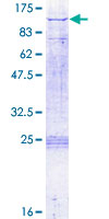 ab161205 on a 12.5% SDS-PAGE stained with Coomassie Blue.