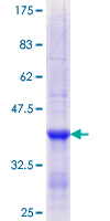 ab153318 on a 12.5% SDS-PAGE stained with Coomassie Blue.