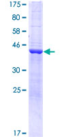 ab162615 on a 12.5% SDS-PAGE stained with Coomassie Blue.